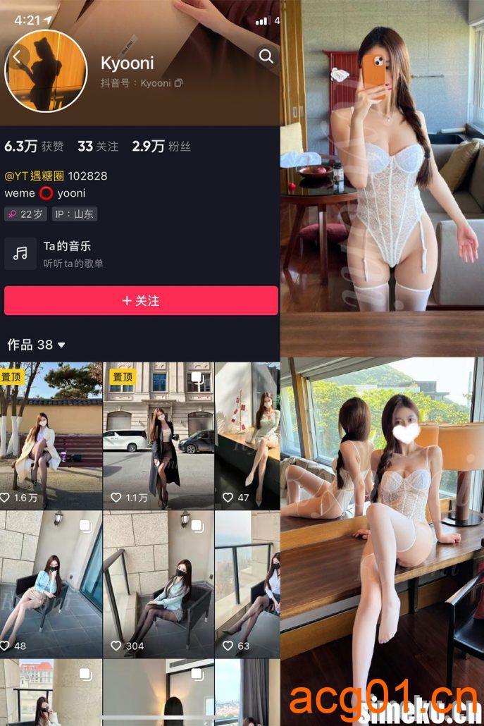 图片[1]-[合集打包]Yooni有你喵/Kyooni微密圈照片视频觅圈合集打包下载+持续更新-次元集
