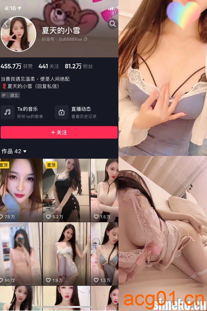 图片[1]-[合集打包]夏天的小雪微密圈照片视频觅圈合集打包下载+持续更新-次元集